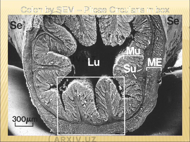 Colon by SEM – Plicae Circularis in box 