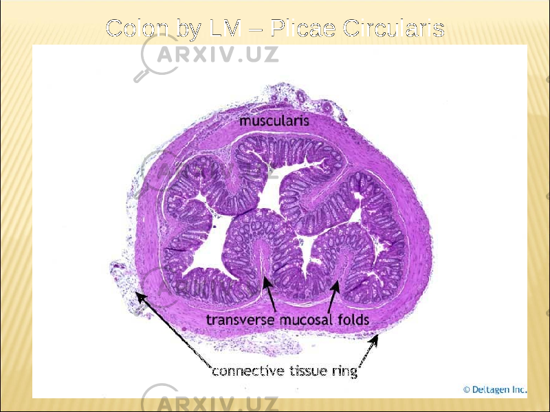 Colon by LM – Plicae Circularis 