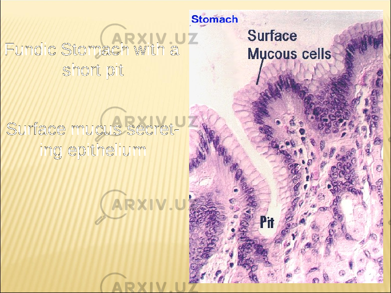 Fundic Stomach with a short pit Surface mucus secret - ing epithelium 