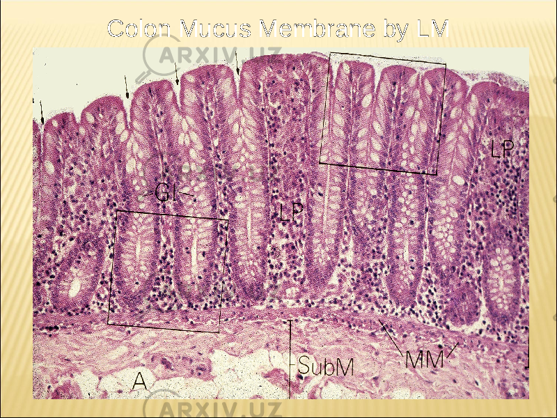 Colon Mucus Membrane by LM 