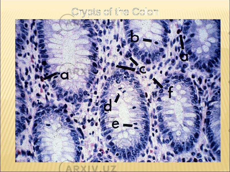 Crypts of the Colon 