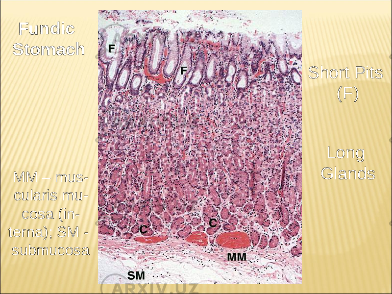 Short Pits (F) Long GlandsF u n d ic S t o m a c h MM – mus - cularis mu - cosa (in - terna); SM - submucosa 