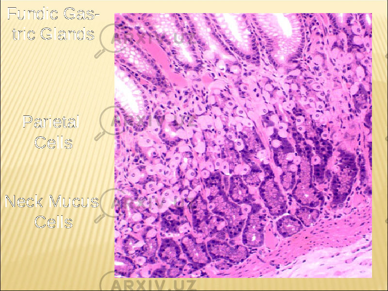 Fundic Gas - tric Glands Parietal Cells Neck Mucus Cells 