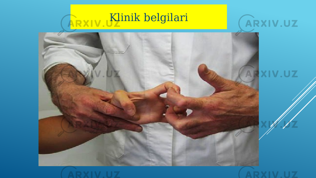 Klinik belgilari 