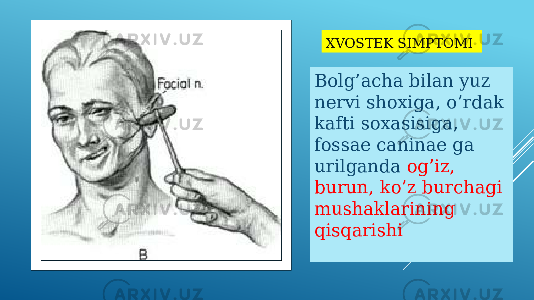 XVOSTEK SIMPTOMI Bolg’acha bilan yuz nervi shoxiga, o’rdak kafti soxasisiga, fossae caninae ga urilganda og’iz, burun, ko’z burchagi mushaklarining qisqarishi 