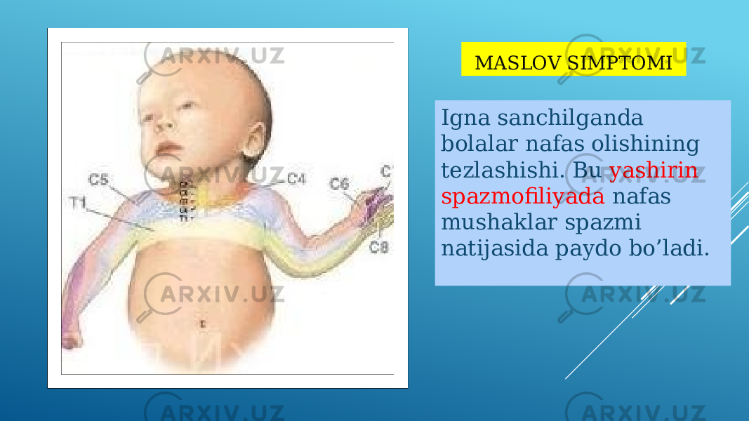 MASLOV SIMPTOMI Igna sanchilganda bolalar nafas olishining tezlashishi. Bu yashirin spazmofiliyada nafas mushaklar spazmi natijasida paydo bo’ladi. 