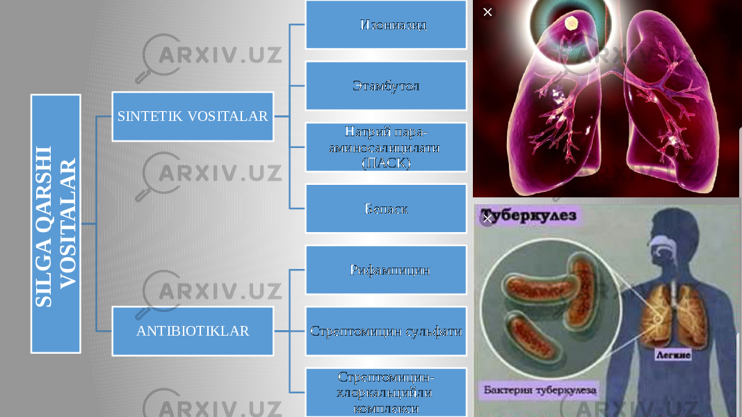 8S I L G A Q A R S H I V O S I T A L A RSINTETIK VOSITALAR Изониазид Этамбутол Натрий пара- аминосалицилати (ПАСК) Бепаск ANTIBIOTIKLAR Рифампицин Стрептомицин сульфати Стрептомицин- хлоркальцийли комплекси 