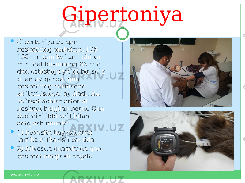 Gipertoniya  Gipertoniya bu qon bosimining maksimal 125- 130mm dan ko`tarilishi va minimal bosimning 85 mm dan oshishiga ya`ni bir so`z bilan aytganda qon bosimining normadan ko`tarilishiga aytiladi. Bu ko`rsatkichlar arterial bosimni belgilab berdi. Qon bosimini ikki yo`l bilan aniqlash mumkin.  1) bevosita hayvonlarda tajriba o`tkazish paytida  2) bilvosita odamlarda qon bosimni aniqlash orqali. www.arxiv.uz 