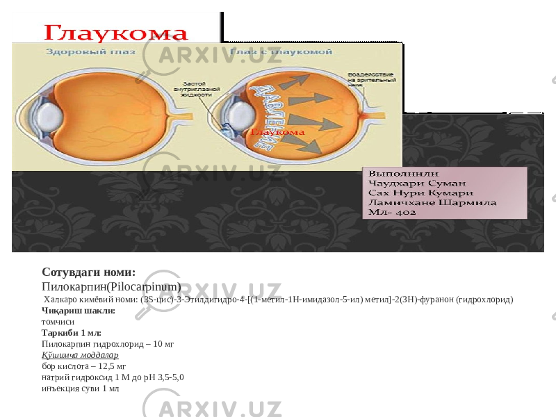Сотувдаги номи: Пилокарпин(Pilocarpinum) Халкаро кимёвий номи: (3S-цис)-3-Этилдигидро-4-[(1-метил-1Н-имидазол-5-ил) метил]-2(ЗН)-фуранон (гидрохлорид) Чиқариш шакли: томчиси Таркиби 1 мл: Пилокарпин гидрохлорид – 10 мг  Қўшимча моддалар   бор кислота – 12,5 мг  натрий гидроксид 1 М до рН 3,5-5,0  инъекция суви 1 мл 