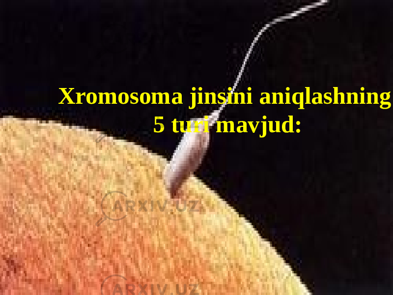 Xromosoma jinsini aniqlashning 5 turi mavjud: 