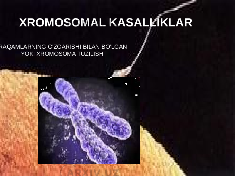 XROMOSOMAL KASALLIKLAR RAQAMLARNING O&#39;ZGARISHI BILAN BO&#39;LGAN YOKI XROMOSOMA TUZILISHI 