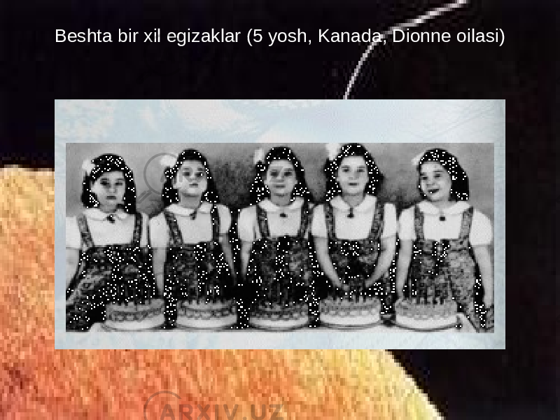 Beshta bir xil egizaklar (5 yosh, Kanada, Dionne oilasi) 