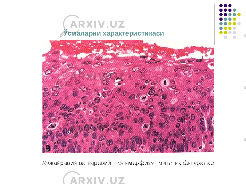 Ўсмаларни характеристикаси Хужайравий ва ядровий полиморфизм, митотик фигуралар 