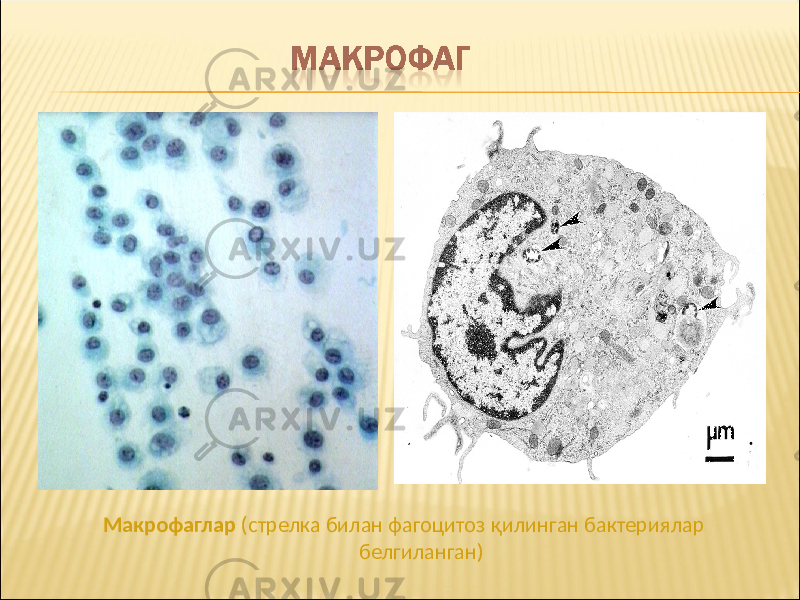 Макрофаглар (стрелка билан фагоцитоз қилинган бактериялар белгиланган) 