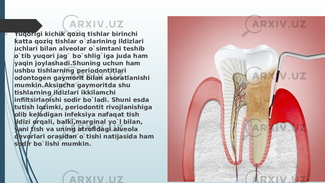  Yuqorigi kichik qoziq tishlar birinchi katta qoziq tishlar o`zlarining ildizlari uchlari bilan alveolar o`simtani teshib o`tib yuqori jag` bo`shlig`iga juda ham yaqin joylashadi.Shuning uchun ham ushbu tishlarning periodontitlari odontogen gaymorit bilan asoratlanishi mumkin.Aksincha gaymoritda shu tishlarning ildizlari ikkilamchi infiltsirlanishi sodir bo`ladi. Shuni esda tutish lozimki, periodontit rivojlanishiga olib keladigan infeksiya nafaqat tish ildizi orqali, balki,marginal yo`l bilan, yani tish va uning atrofidagi alveola devorlari orasidan o`tishi natijasida ham sodir bo`lishi mumkin. 