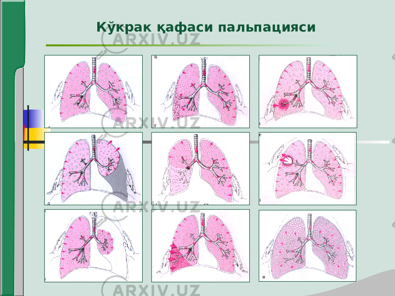 Кўкрак қафаси пальпацияси 