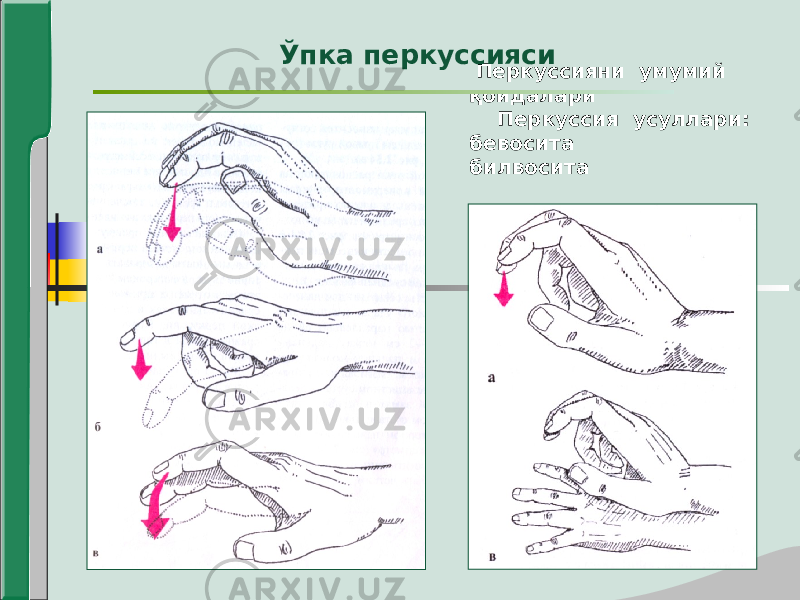  Перкуссияни умумий қоидалари Перкуссия усуллари: бевосита билвоситаЎпка перкуссияси 