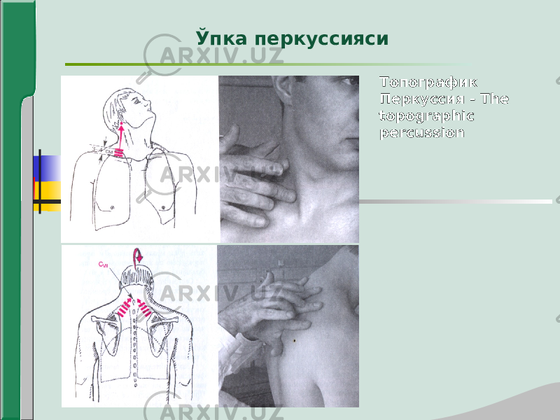 Топографик Перкуссия - The topographic percussionЎпка перкуссияси 