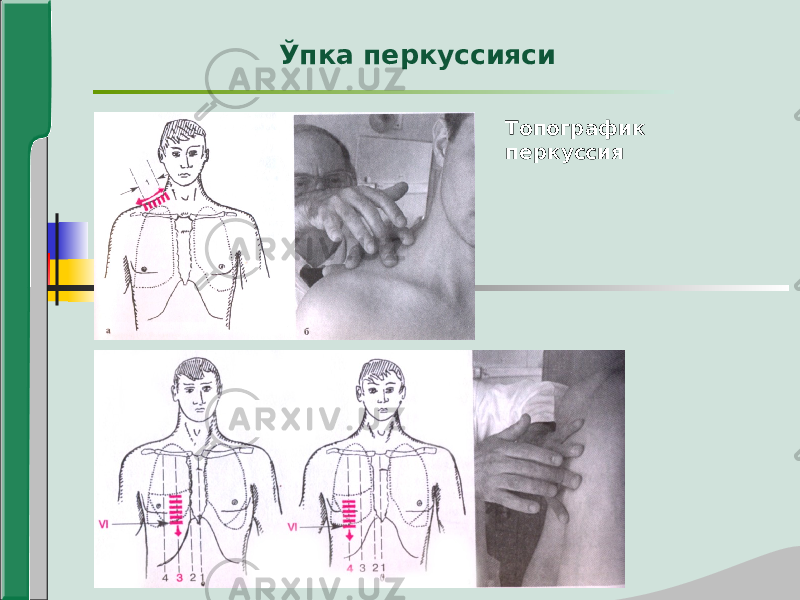 Топографик перкуссияЎпка перкуссияси 