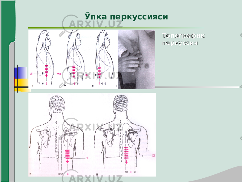 Топографик перкуссияЎпка перкуссияси 