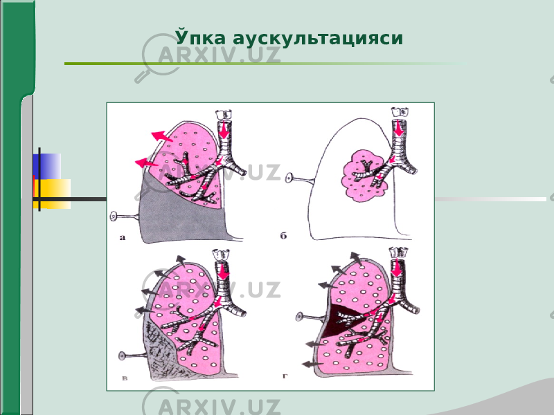 Ўпка аускультацияси 