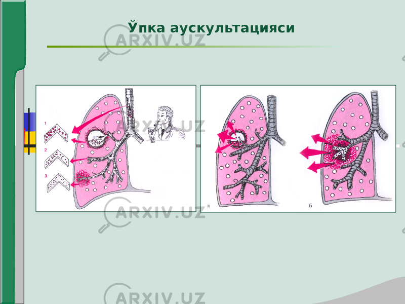 Ўпка аускультацияси 