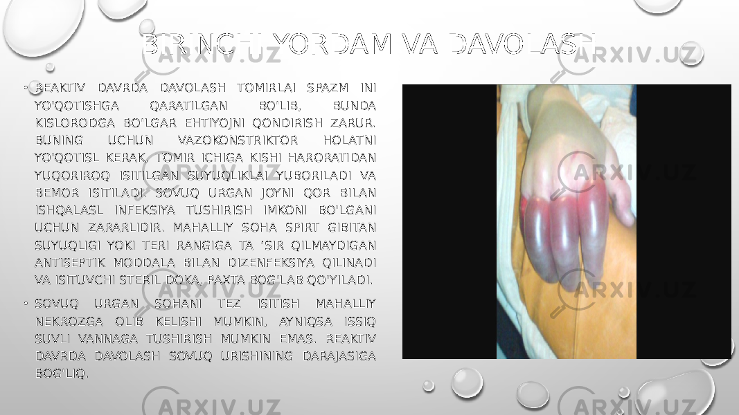 BIRINCHI YORDAM VA DAVOLASH • REAKTIV DAVRDA DAVOLASH TOMIRLAI SPAZM INI YO&#39;QOTISHGA QARATILGAN BO&#39;LIB, BUNDA KISLORODGA BO&#39;LGAR EHTIYOJNI QONDIRISH ZARUR. BUNING UCHUN VAZOKONSTRIKTOR HOLATNI YO&#39;QOTISL KERAK, TOMIR ICHIGA KISHI HARORATIDAN YUQORIROQ ISITILGAN SUYUQLIKLAI YUBORILADI VA BEMOR ISITILADI. SOVUQ URGAN JOYNI QOR BILAN ISHQALASL INFEKSIYA TUSHIRISH IMKONI BO&#39;LGANI UCHUN ZARARLIDIR. MAHALLIY SOHA SPIRT GIBITAN SUYUQLIGI YOKI TERI RANGIGA TA ’SIR QILMAYDIGAN ANTISEPTIK MODDALA BILAN DIZENFEKSIYA QILINADI VA ISITUVCHI STERIL DOKA, PAXTA BOG&#39;LAB QO&#39;YILADI. • SOVUQ URGAN SOHANI TEZ ISITISH MAHALLIY NEKROZGA OLIB KELISHI MUMKIN, AYNIQSA ISSIQ SUVLI VANNAGA TUSHIRISH MUMKIN EMAS. REAKTIV DAVRDA DAVOLASH SOVUQ URISHINING DARAJASIGA BOG&#39;LIQ. 