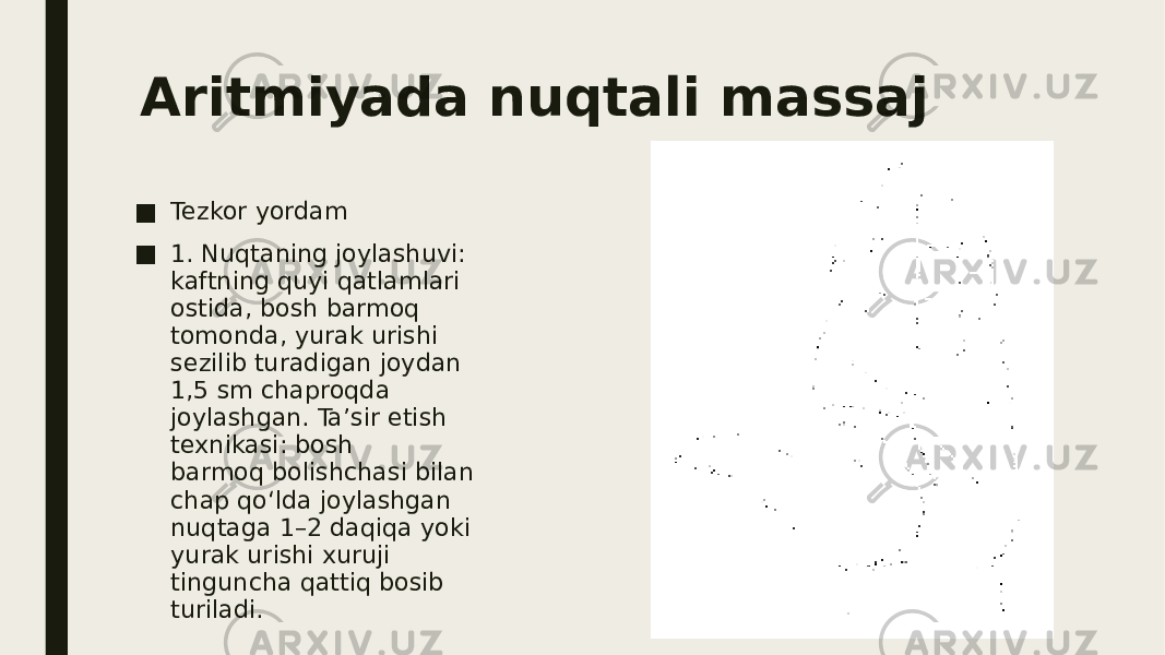 Aritmiyada nuqtali massaj ■ Tezkor yordam ■ 1. Nuqtaning joylashuvi: kaftning quyi qatlamlari ostida, bosh barmoq tomonda, yurak urishi sezilib turadigan joydan 1,5 sm chaproqda joylashgan. Ta’sir etish texnikasi: bosh barmoq bolishchasi bilan chap qo‘lda joylashgan nuqtaga 1–2 daqiqa yoki yurak urishi xuruji tinguncha qattiq bosib turiladi. 