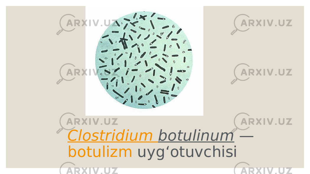 Clostridium botulinum  —  botulizm  uygʻotuvchisi 