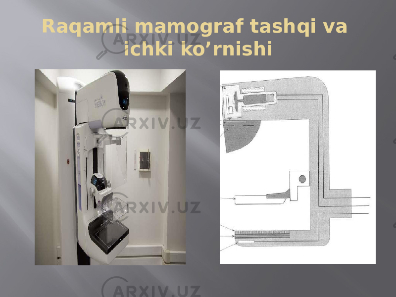 Raqamli mamograf tashqi va ichki ko’rnishi 