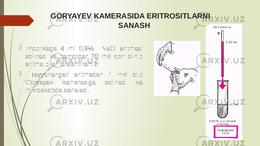  GORYAYEV KAMERASIDA ERITROSITLARNI SANASH  Probirkaga 4 ml 0,9% NaCl eritmasi solinadi va bemordan 20 mkl qon olinib eritma bilan aralshtiramiz.  Tayyorlangan eritmadan 1 mkl olib Goryayev kamerasiga solinadi va mikroskopda sanaladi. 