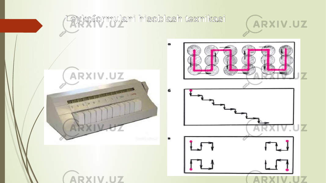 Leykoformulani hisoblash texnikasi 