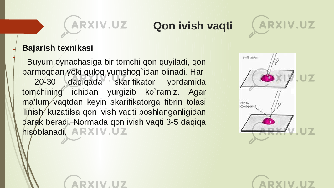 Qon ivish vaqti  Bajarish texnikasi  Buyum oynachasiga bir tomchi qon quyiladi, qon barmoqdan yoki quloq yumshog`idan olinadi. Har 20-30 daqiqada skarifikator yordamida tomchining ichidan yurgizib ko`ramiz. Agar ma’lum vaqtdan keyin skarifikatorga fibrin tolasi ilinishi kuzatilsa qon ivish vaqti boshlanganligidan darak beradi. Normada qon ivish vaqti 3-5 daqiqa hisoblanadi. 