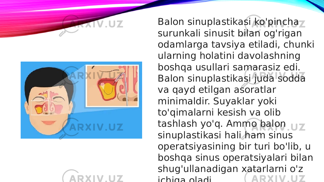 Balon sinuplastikasi ko&#39;pincha surunkali sinusit bilan og&#39;rigan odamlarga tavsiya etiladi, chunki ularning holatini davolashning boshqa usullari samarasiz edi. Balon sinuplastikasi juda sodda va qayd etilgan asoratlar minimaldir. Suyaklar yoki to&#39;qimalarni kesish va olib tashlash yo&#39;q. Ammo balon sinuplastikasi hali ham sinus operatsiyasining bir turi bo&#39;lib, u boshqa sinus operatsiyalari bilan shug&#39;ullanadigan xatarlarni o&#39;z ichiga oladi. 