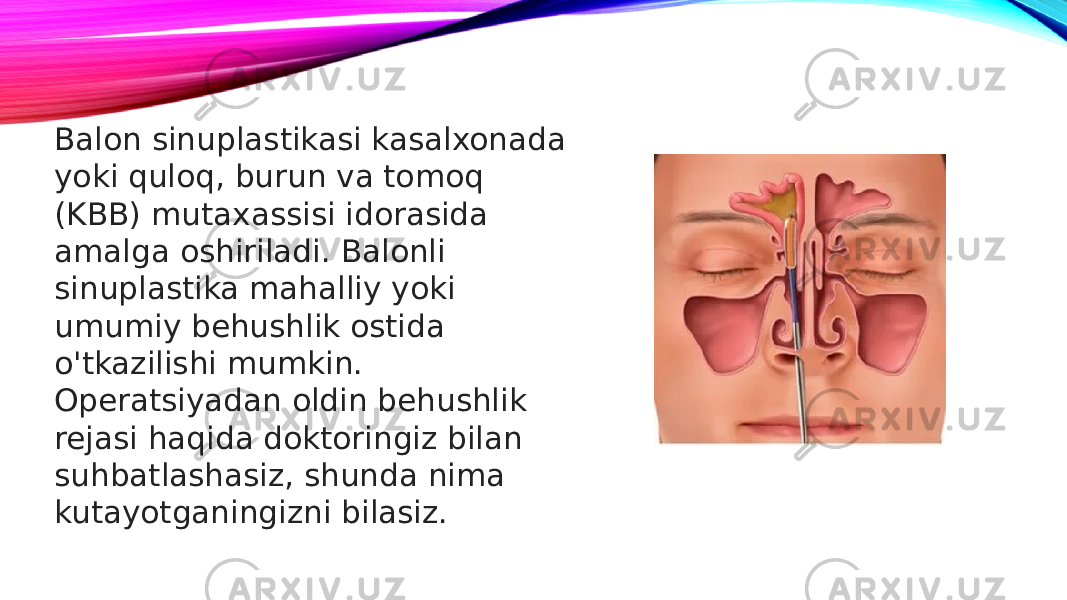 Balon sinuplastikasi kasalxonada yoki quloq, burun va tomoq (KBB) mutaxassisi idorasida amalga oshiriladi. Balonli sinuplastika mahalliy yoki umumiy behushlik ostida o&#39;tkazilishi mumkin. Operatsiyadan oldin behushlik rejasi haqida doktoringiz bilan suhbatlashasiz, shunda nima kutayotganingizni bilasiz. 