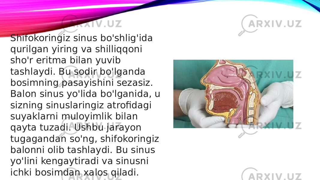 Shifokoringiz sinus bo&#39;shlig&#39;ida qurilgan yiring va shilliqqoni sho&#39;r eritma bilan yuvib tashlaydi. Bu sodir bo&#39;lganda bosimning pasayishini sezasiz. Balon sinus yo&#39;lida bo&#39;lganida, u sizning sinuslaringiz atrofidagi suyaklarni muloyimlik bilan qayta tuzadi. Ushbu jarayon tugagandan so&#39;ng, shifokoringiz balonni olib tashlaydi. Bu sinus yo&#39;lini kengaytiradi va sinusni ichki bosimdan xalos qiladi. 