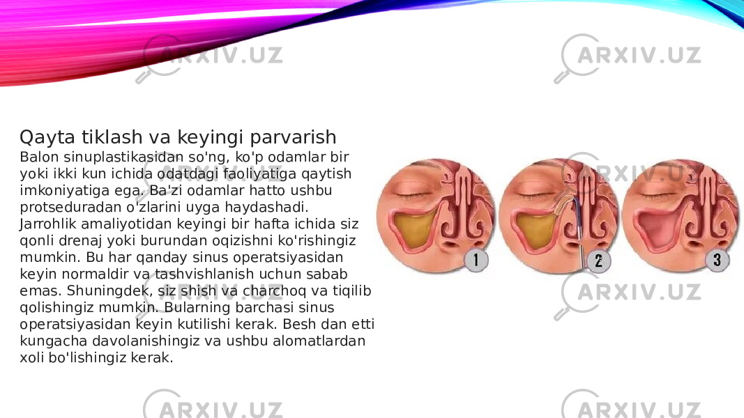 Qayta tiklash va keyingi parvarish Balon sinuplastikasidan so&#39;ng, ko&#39;p odamlar bir yoki ikki kun ichida odatdagi faoliyatiga qaytish imkoniyatiga ega. Ba&#39;zi odamlar hatto ushbu protseduradan o&#39;zlarini uyga haydashadi. Jarrohlik amaliyotidan keyingi bir hafta ichida siz qonli drenaj yoki burundan oqizishni ko&#39;rishingiz mumkin. Bu har qanday sinus operatsiyasidan keyin normaldir va tashvishlanish uchun sabab emas. Shuningdek, siz shish va charchoq va tiqilib qolishingiz mumkin. Bularning barchasi sinus operatsiyasidan keyin kutilishi kerak. Besh dan etti kungacha davolanishingiz va ushbu alomatlardan xoli bo&#39;lishingiz kerak. 