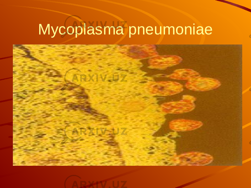 Mycoplasma pneumoniae 