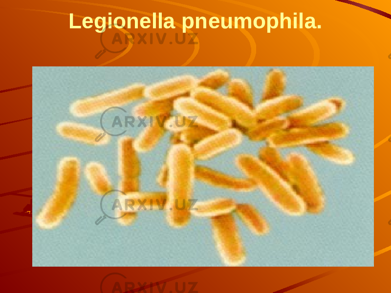 Legionella pneumophila. 