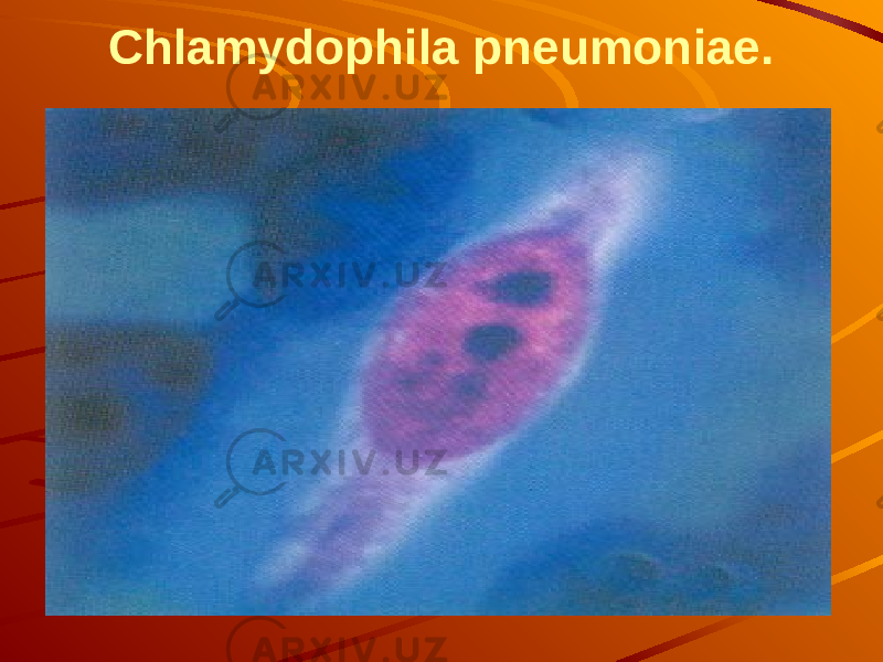 Chlamydophila pneumoniae. 