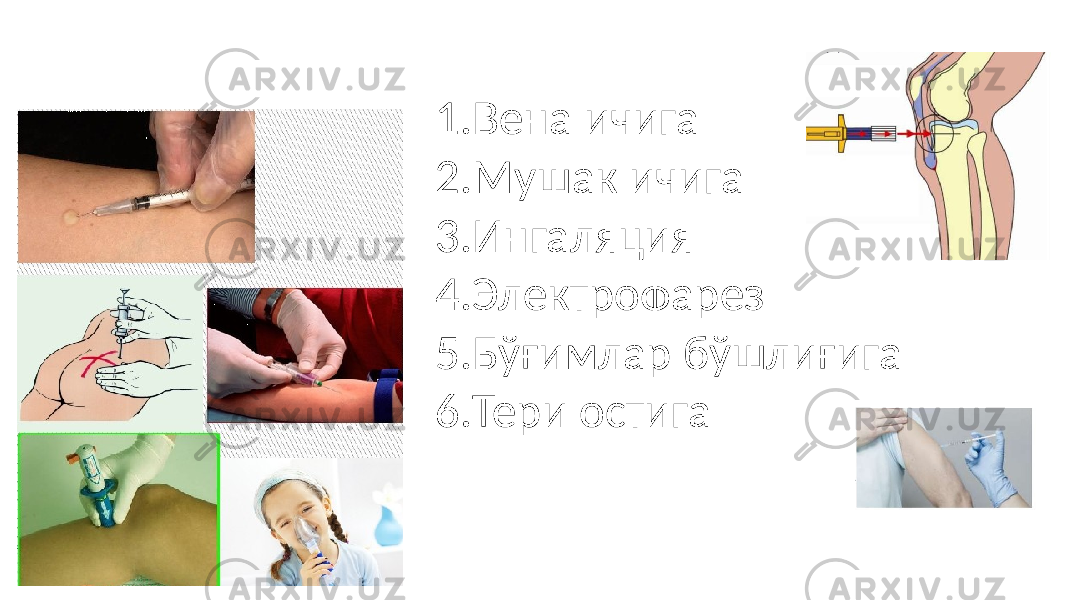 1.Вена ичига 2.Мушак ичига 3.Ингаляция 4.Электрофарез 5.Бўғимлар бўшлиғига 6.Тери остига 