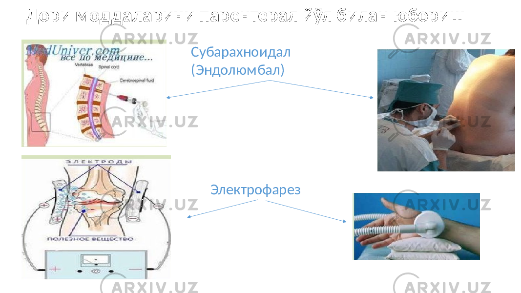  Дори моддаларини парентерал йўл билан юбориш Субарахноидал (Эндолюмбал) Электрофарез 