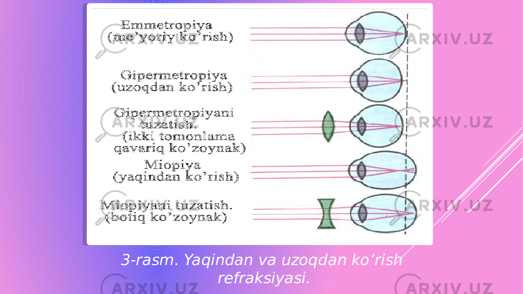 3-rasm. Yaqindan va uzoqdan ko’rish refraksiyasi.   