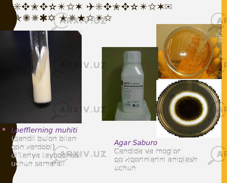 SELEKTIV (SELEKTIV) OZUQA MUHITI  Loefflerning muhiti (qandli bulon bilan qon zardobi) - difteriya tayoqchasi uchun samarali Agar Saburo Candida va mog&#39;or qo&#39;ziqorinlarini aniqlash uchun 