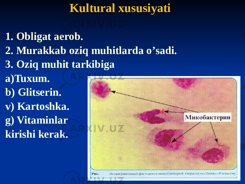 Kultural xususiyati 1. Obligat aerob. 2. Murakkab oziq muhitlarda oʼsadi. 3. Oziq muhit tarkibiga a)Tuxum. b) Glitserin. v) Kartoshka. g) Vitaminlar kirishi kerak. 