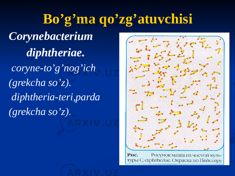 Boʼgʼma qoʼzgʼatuvchisi Corynebacterium diphtheriae. coryne-to’g’nog’ich (grekcha so’z). diphtheria-teri,parda (grekcha so’z). 