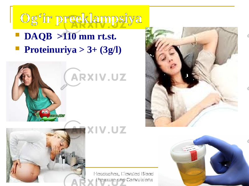 Headaches, Elevated Blood Pressure and Convulsions 19Ogʻir preeklampsiya  DАQB >110 mm rt.st.  Proteinuriya > 3+ (3g/l) 