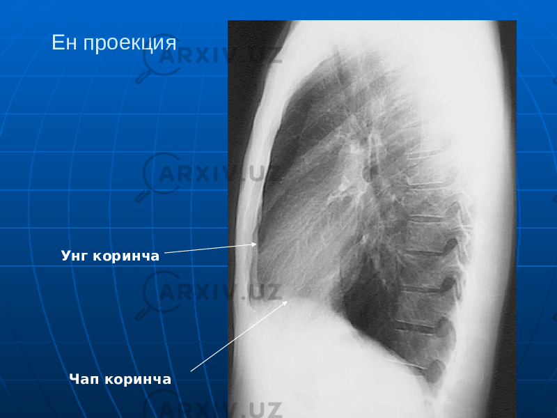 Ен проекция Унг коринча Чап коринча 