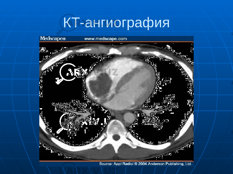 КТ-ангиография 
