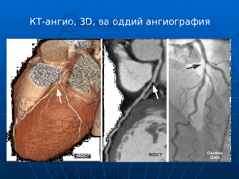 КТ-ангио, 3D, ва оддий ангиография 